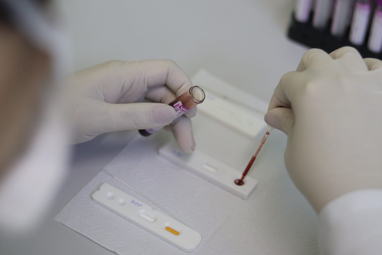 Suzano reforça ações de prevenção ao HIV nos 24 postos de saúde a partir da semana que vem