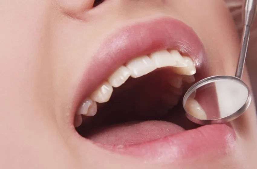 APCD-RMC alerta que câncer oral é o quarto tumor mais frequente em pacientes do sexo masculino