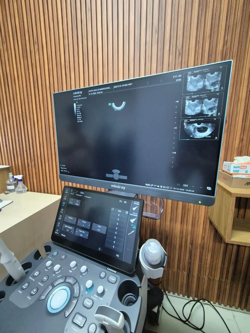 Inteligência artificial no ultrassom otimiza exames na Santa Casa de Mogi